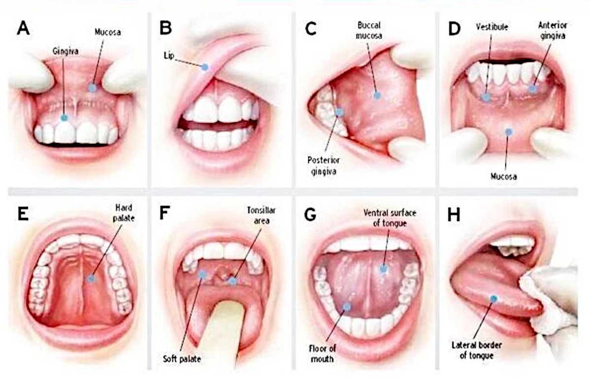 The Mouth Check That Could Save Your Life From Oral Cancer